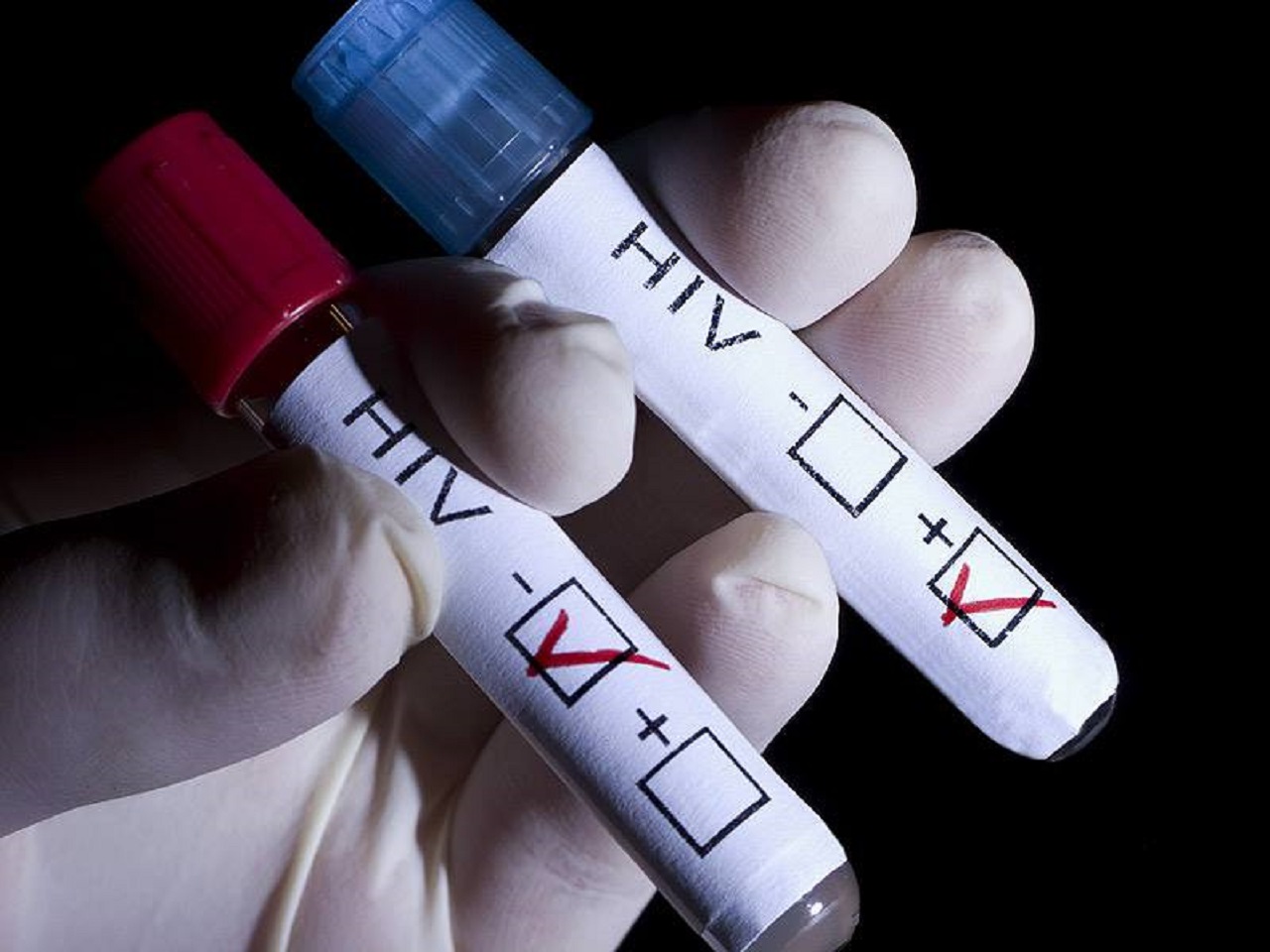 Vlani pribudlo 103 nových prípadov HIV, oproti roku 2021 ich počet klesol